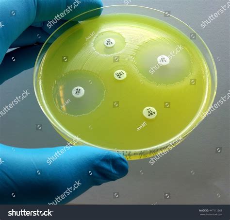 omega hospital pseudomonas drop test